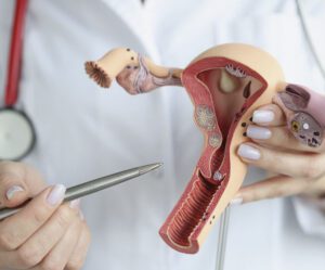 Misoprostol como colocar comprimido no colo do útero